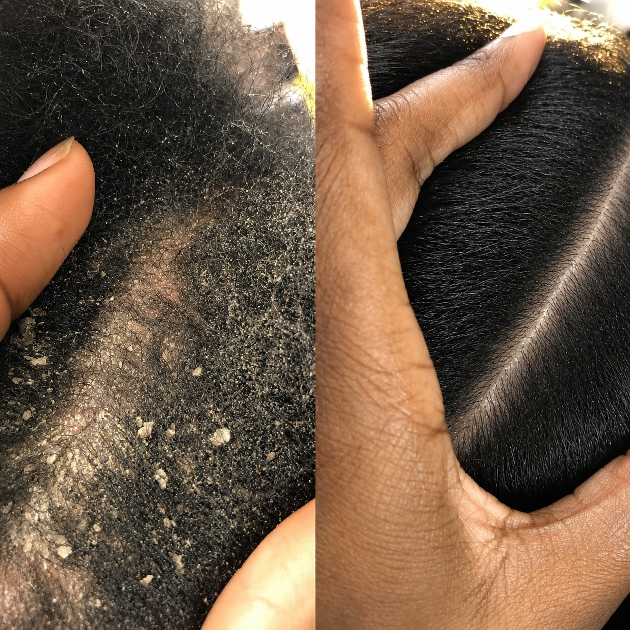 KMANICHE BOOST™ Hair Treatment Oil - ARIANA 30%