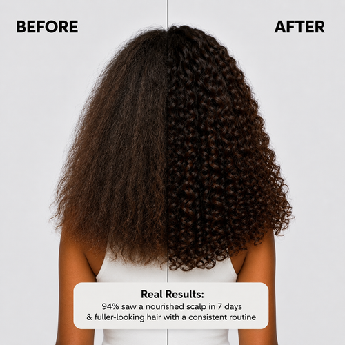 Huile Kmaniche pour la croissance des cheveux et de la barbe