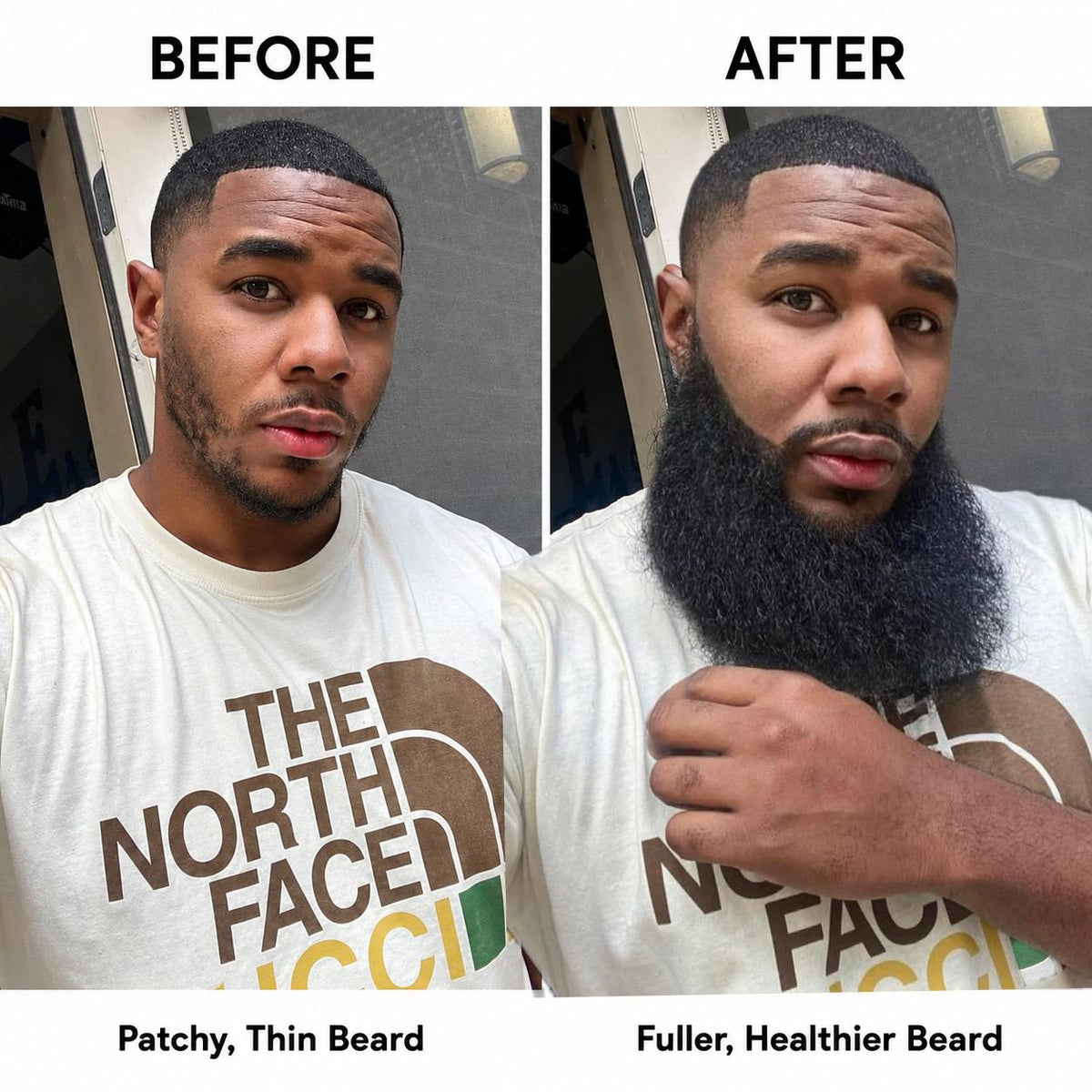 Beard results with BOOST